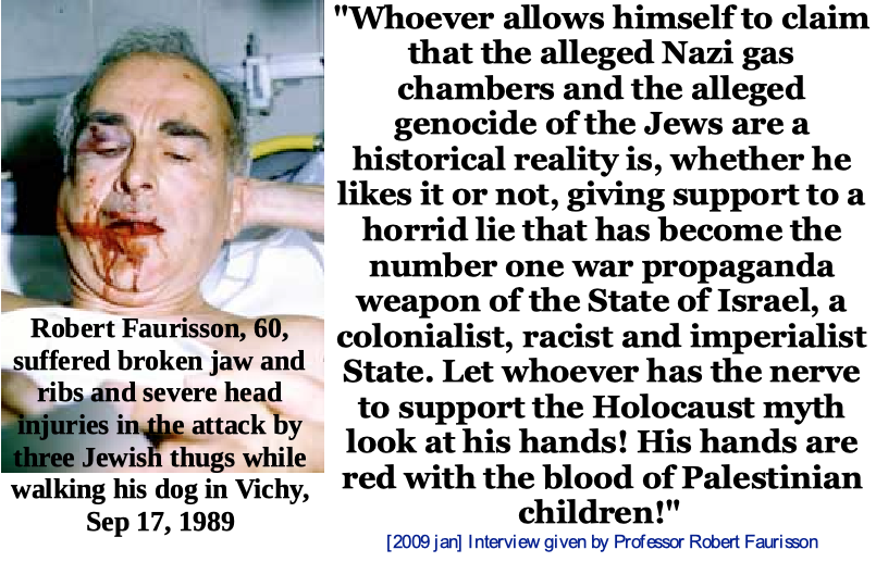 Robert Faurisson, 60, suffered broken jaw and ribs, and severe head injuries in the attack by three Jewish Thugs while walking his dog in Vichy, Sep 17, 1989

"Whoever allows himself to claim that the alleged Nazi gas chambers and the alleged genocide of the Jews are a historical reality is, whether he likes it or not, giving support to a horrid lie that has become the number one war propaganda weapon of the State of Israel, a colonialist, racist and imperialist State. Let whoever has the nerve to support the Holocaust myth look at his hands! his hands are red with the blood of Palestinina children!" (2009 Jan) Interview given by Profssor Robert Faurisson
